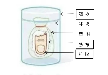 【專(zhuān)科技術(shù)】驚心！又是電鋸！裝修師傅們千萬(wàn)要小心了！